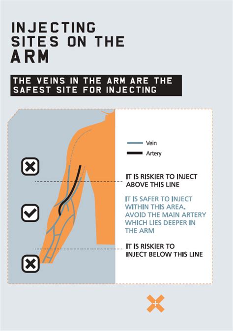 A Guide To Safer Injecting Hit