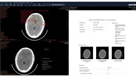 How To Qer Radiology Ai In Sectra Pacs Youtube