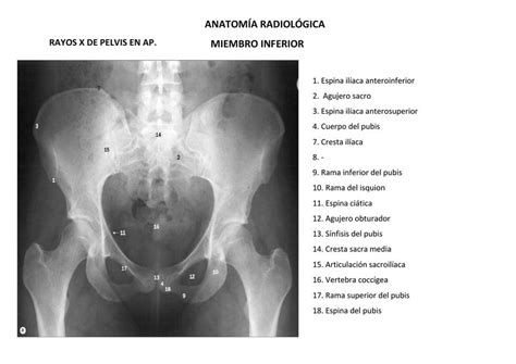 Anatomía Radiológica Miembro Inferior Mailyn Milla Udocz