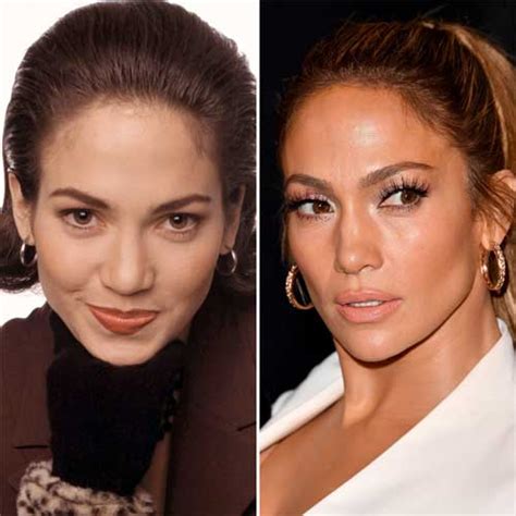 Jennifer Lopez Plastic Surgery Nose Job J Lo Surgery Botox