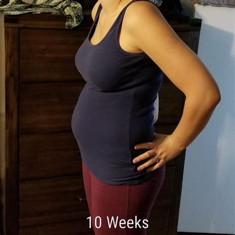 10 Weeks Pregnant With Twins Tips Advice How To Prep Twiniversity