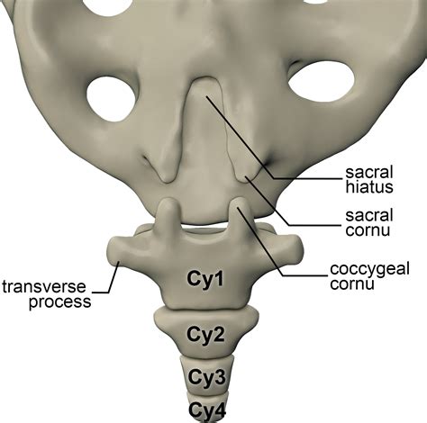 Imaging Coccygeal Trauma And Coccydynia Radiographics