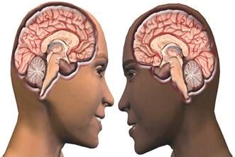 El Cerebro Del Hombre El Cerebro De La Mujer Existen Diferencias