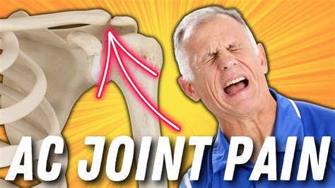 Effective Self Treatment For Ac Joint Pain Acromioclavicular Joint Pain