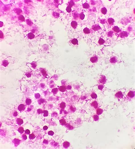 Gram Stain Of Sneathia Amnii Colonies From Positive Blood Culture