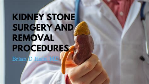 Kidney Stone Removal Ls