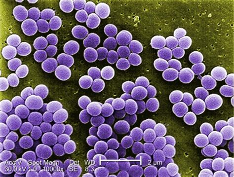 Staphylococcus Saprophyticus Colony Morphology