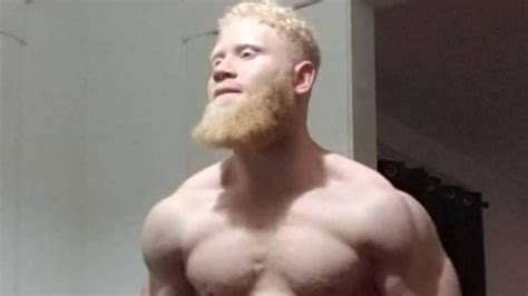 American Fitness Fanatic Claims To Be The Strongest Albino Alive