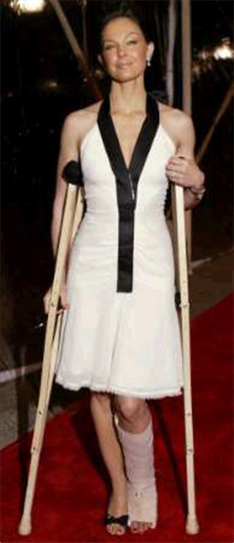 Ashley judd is currently hospitalized in south africa after shattering her leg in the congo region of. Eucalyptus - March 2004 Archives