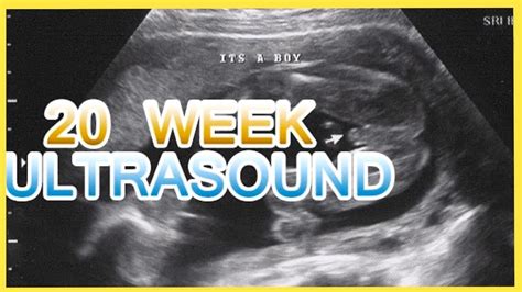 Baby Gender Reveal 20 Week Pregnancy Ultrasound Sonogram Reveal