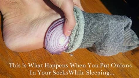 Benefits Of Putting Onion On Your Foot Read The Full Article On This