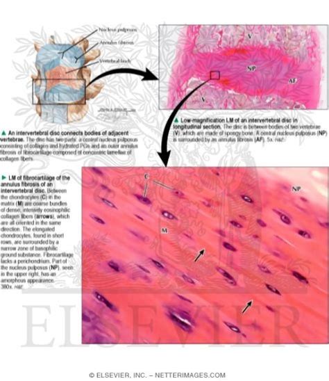 Fibrocartilage Under Microscope Labeled Micropedia