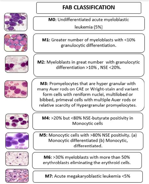 Fab Classification Of Acute Myeloid Leukemia Download Scientific Diagram