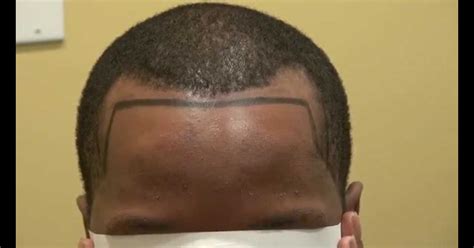 View how to fix receding hairline black male
