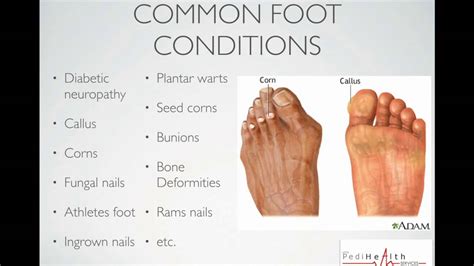 Foot Care Presentation Youtube