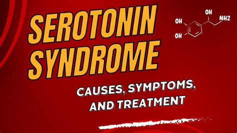 Serotonin Syndrome Causes Symptoms And Treatment Youtube