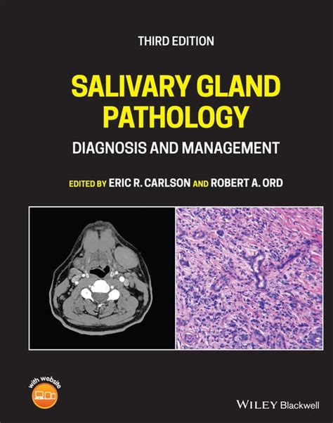 Salivary Gland Pathology Diagnosis And Management Hardcover