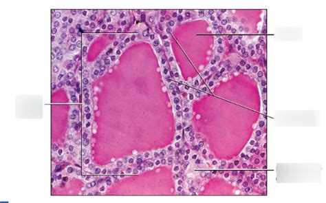 Thyroid Gland Photomicrograph Labeling Diagram Quizlet