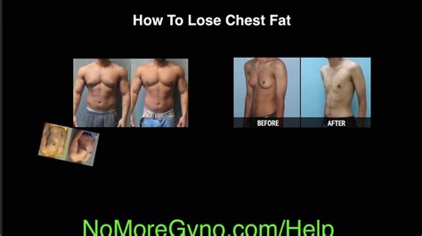 How To Lose Chest Fat Man Boobs Get Rid Of Chest Fat Youtube