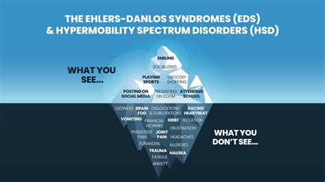 The Iceberg Model Of Ehlers Danlos Syndromes Eds And Hypermobility