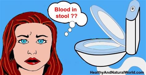 Blood In Stool Pooping Blood What It Means And When To See A Doctor