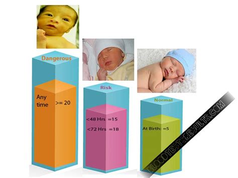 Bilirubin Levels Chart Newborn