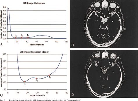 Automatic Method To Assess Local Ct Mr Imaging Registration Accuracy On