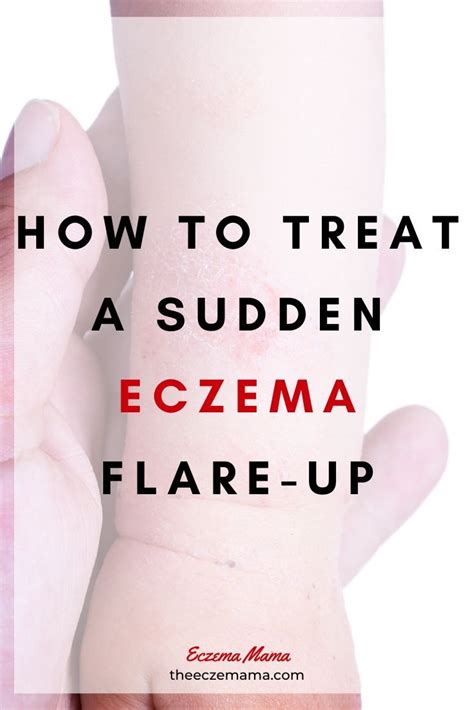 How To Treat A Sudden Eczema Flare Up Eczema Mama