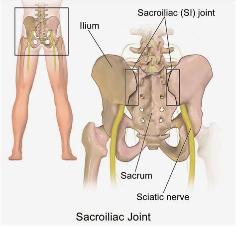 Kerengsaan perut kerap dari kolitis ulseratif boleh menyebabkan sakit belakang di bahagian pinggang sebelah kanan. Penyebab sakit pinggang sebelah kanan bagian belakang ...