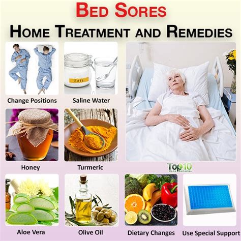 Bed Sores Home Treatment And Remedies Top 10 Home Remedies