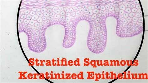 Stratified Squamous Keratinized And Non Keratinized Epithelium