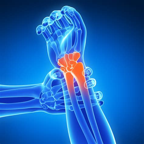 Joint Pain Facts Types And Prevention Looven