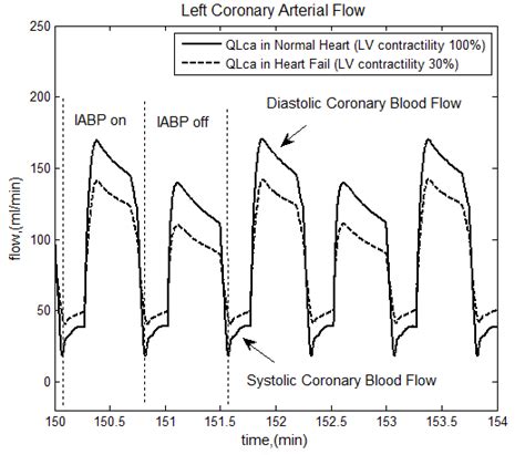 Arterial Pressure Waveform With Iabp 12 Upper Panel And With Iabp