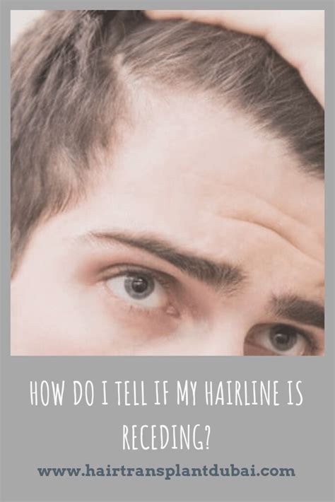 Symptoms to understand that you are losing hair. How Do I Tell If My Hairline Is Receding? | Looking in the ...