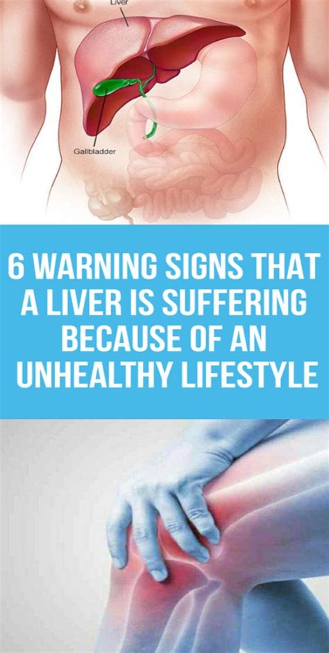 6 Warning Signs That A Liver Is Suffering Because Of An Unhealthy