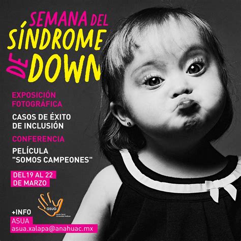 El síndrome de down se genera cuando se produce una división celular anormal en el cromosoma 21. Semana del Síndrome de Down | Universidad Anáhuac Xalapa