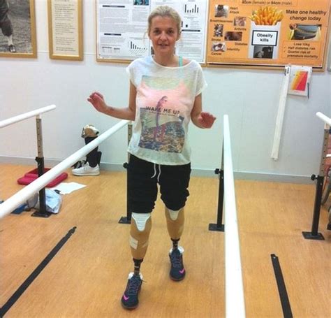 Rochford Leg Amputee Mum Tracy Ralph Begins Rehabilitation Bbc News