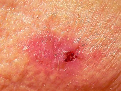 Causes Of Scaly Skin—and How To Get Rid Of It