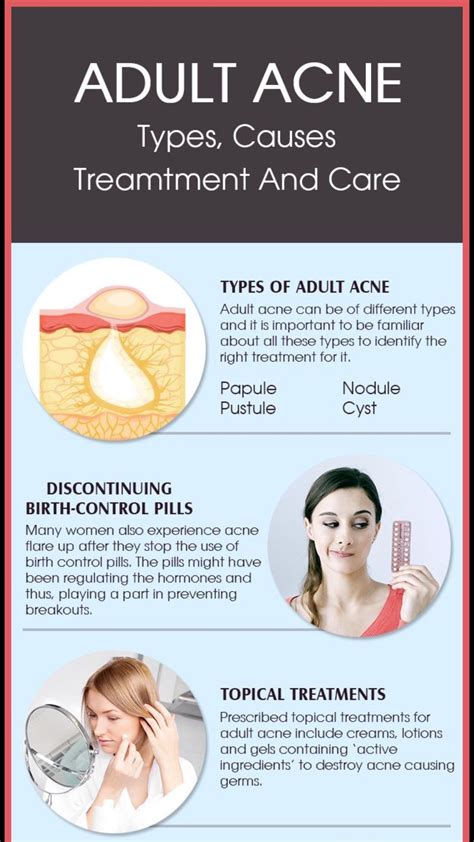 Adult Acne Types Causes Treatment And Care Musely