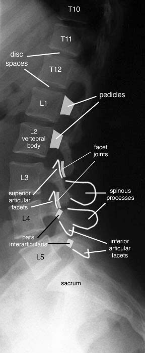Lumbar Vertebrae Anatomy Lateral
