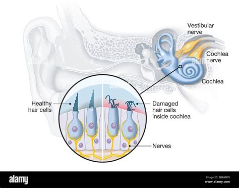 Cochlea Hair Cells