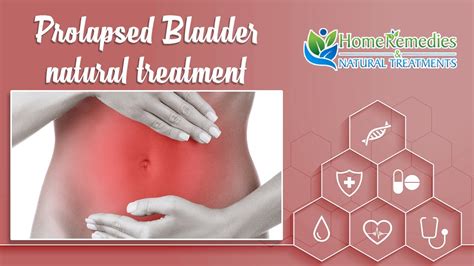 natural treatments and home remedies for prolapsed bladder youtube