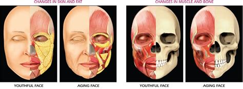 Anatomy Of Facial Aging Grosse Pointe Dermatology