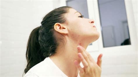 How To Get Rid Of Neck Pimples Human Equine Aliance