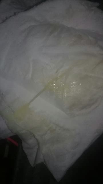 Vaginal Discharge Or Possible Mucus Plug Tmi Pic Attached Glow My Xxx