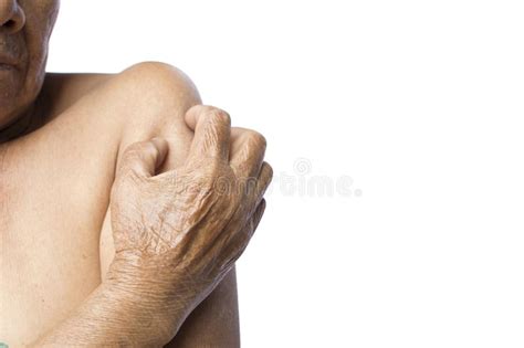 Old Hands Itching In Elbow Stock Image Image Of Bite