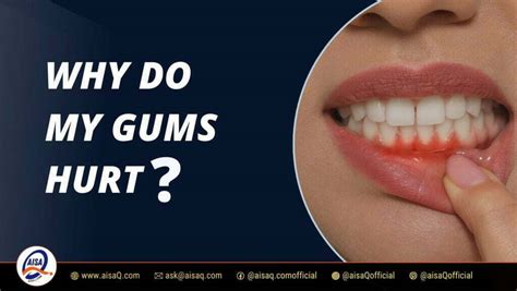Why Do My Gums Hurt Common Causes And Remedies