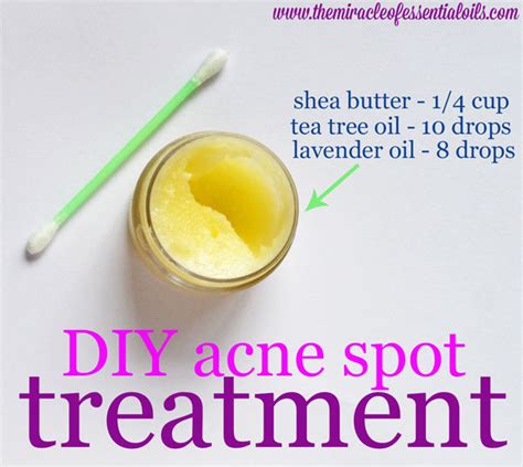 Diy Essential Oil Acne Spot Treatment The Miracle Of Essential Oils