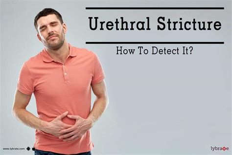Urethral Stricture How To Detect It By Dr Harbinder Singh Lybrate