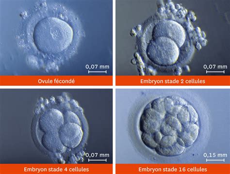 Comment Les Cellules De L Organisme Peuvent Elles Avoir Le M Me Nombre De Chromosomes